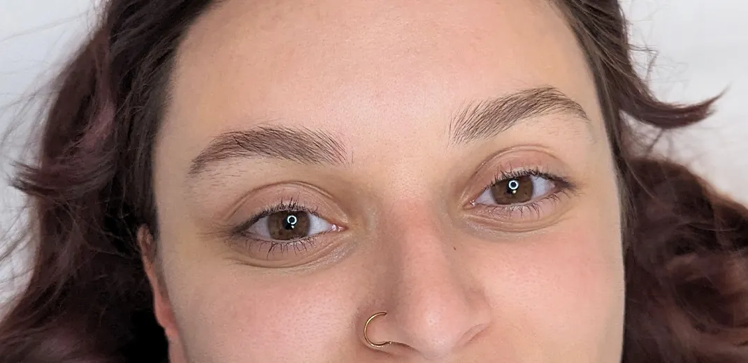 image before