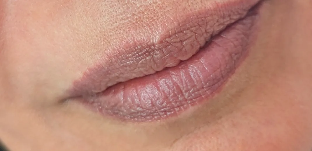 image before