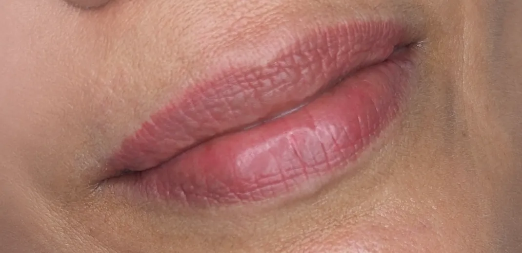 image after