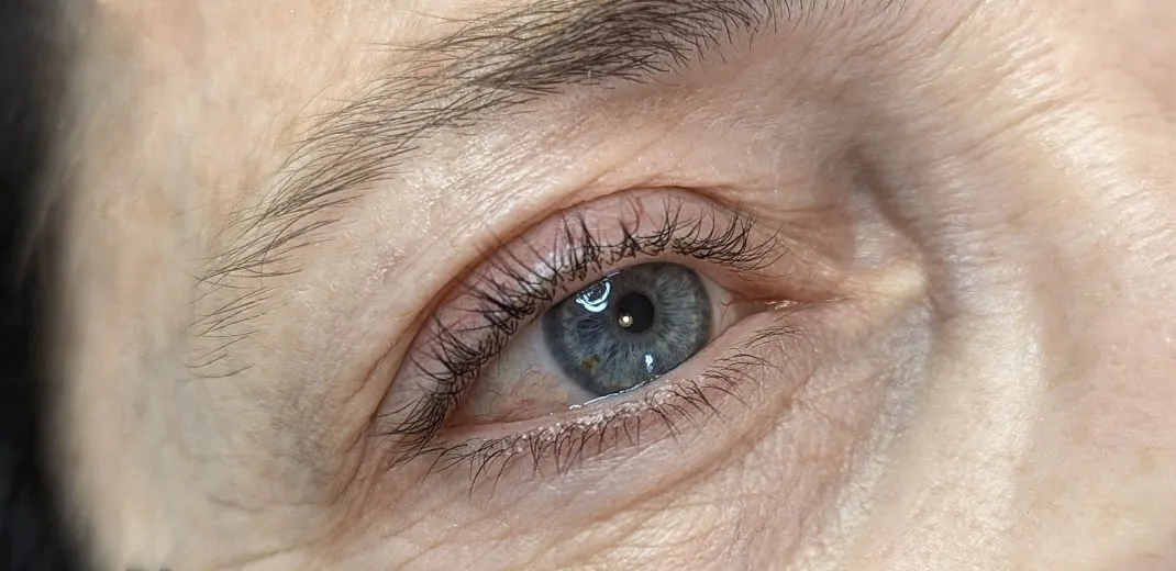 image before