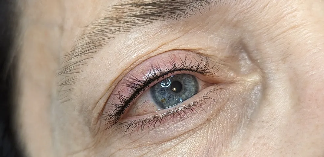 image after